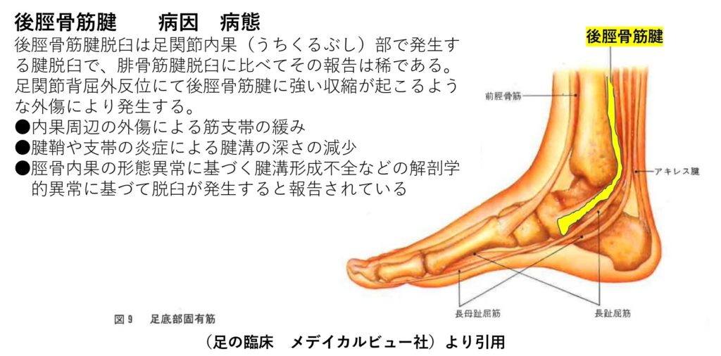 ねんざの合併症 後脛骨筋腱脱臼 福岡市城南区の整形外科 タケダスポーツクリニック